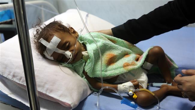 '500 Yemeni kids driven into malnutrition weekly'