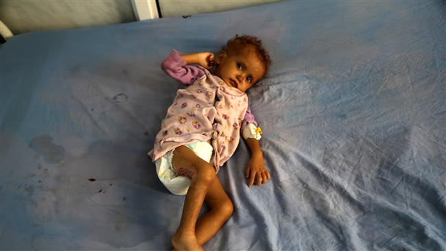 Croix-Rouge: le Yémen se meurt!