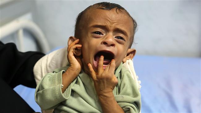 Labour Party accuses UK of killing children in Yemen