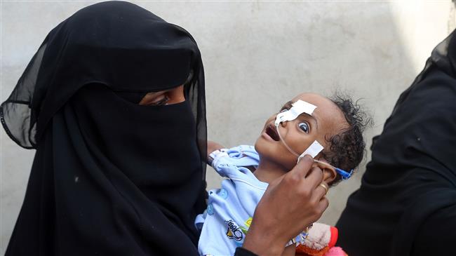 UN: 8.4 million war-hit Yemenis need urgent food aid