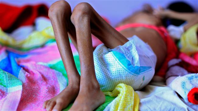 14mn Yemenis on brink of famine, 35 NGOs warn