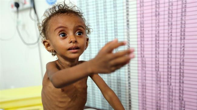 Tickling a Yemeni child 'like tickling a ghost': UN official