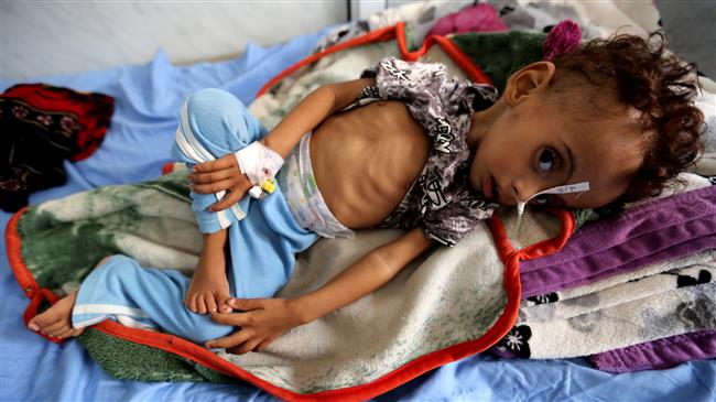 ‘85,000 Yemeni kids may have died of hunger amid Saudi war’