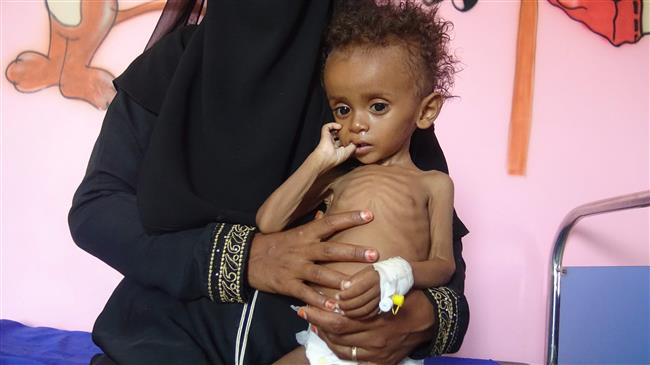 ‘Over 50% of Yemenis face severe acute food insecurity’ 