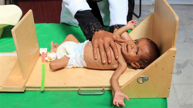 Humanitarian crisis deteriorating in Yemen, UN warns 