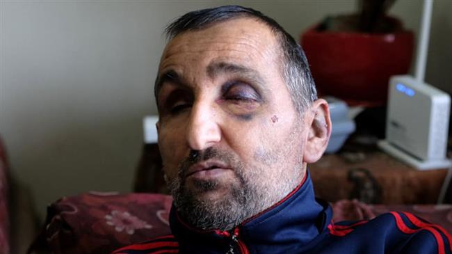 Israeli troops use brass knuckles to beat up blind man