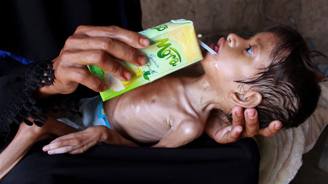 Yemeni kids at risk amid COVID-19 pandemic