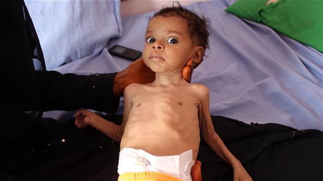 ‘A child dies every 10 minutes’ in Yemen