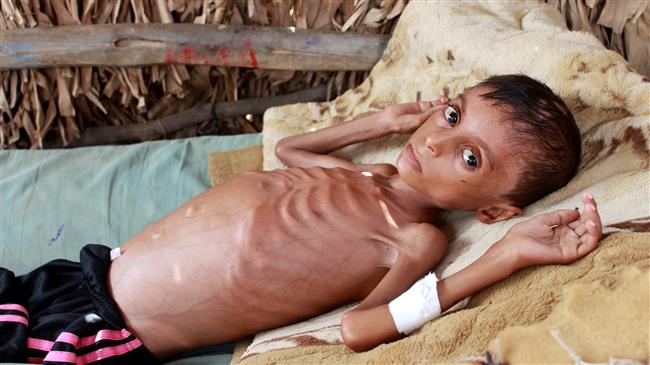UN, intl. aid agencies warn US against blacklisting Yemen’s Ansarullah