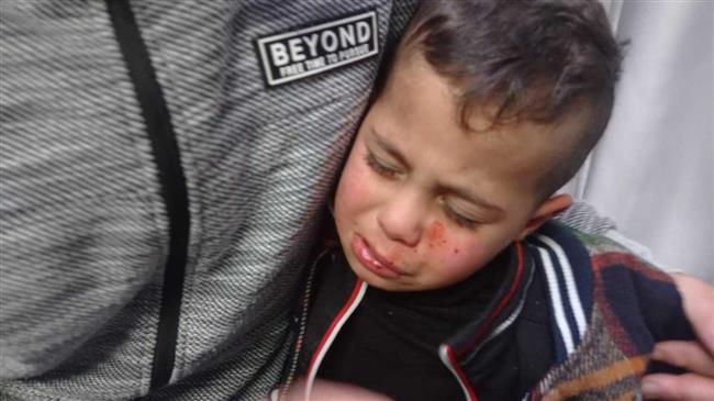 Kids left bloodied after Israelis attack Palestinian families with rocks