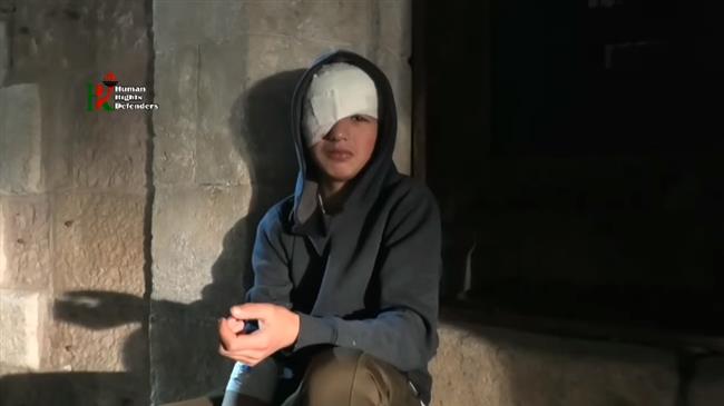 Watch: Palestinian teen loses eye in Israeli shooting at a shop 